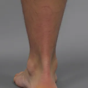 Lower Leg